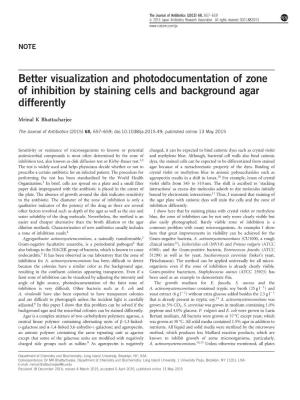 Better Visualization and Photodocumentation of Zone of Inhibition by Staining Cells and Background Agar Differently