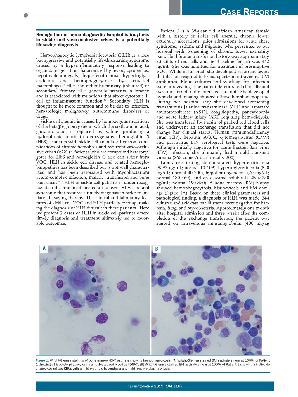 Recognition of Hemophagocytic Lymphohistiocytosis in Sickle Cell