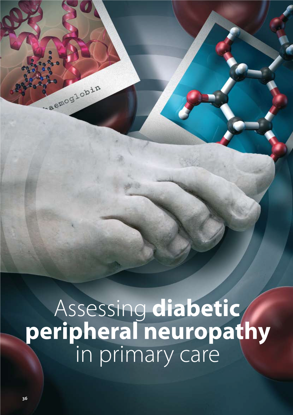 Assessing Diabetic Peripheral Neuropathy in Primary Care