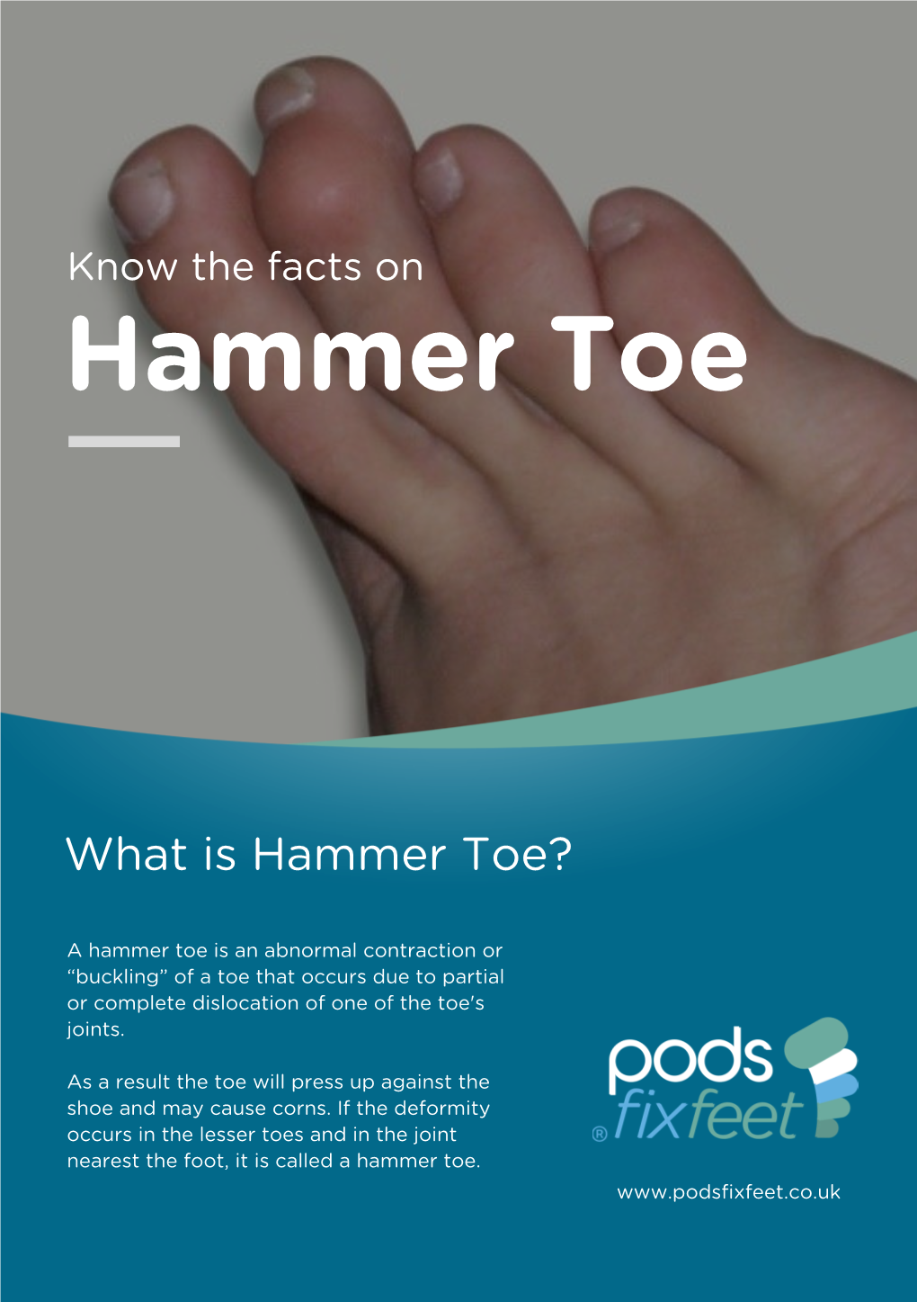 Hammer Toe V3