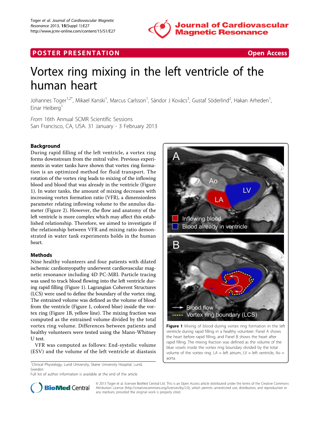 Vortex Ring Mixing in the Left Ventricle of the Human Heart