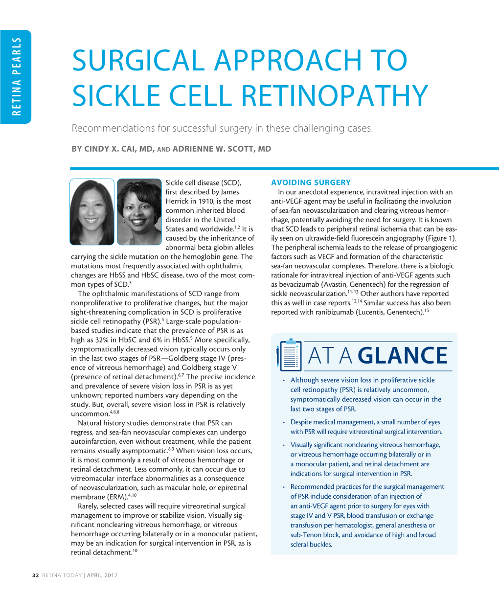 SURGICAL APPROACH to SICKLE CELL RETINOPATHY RETINA PEARLS RETINA Recommendations for Successful Surgery in These Challenging Cases