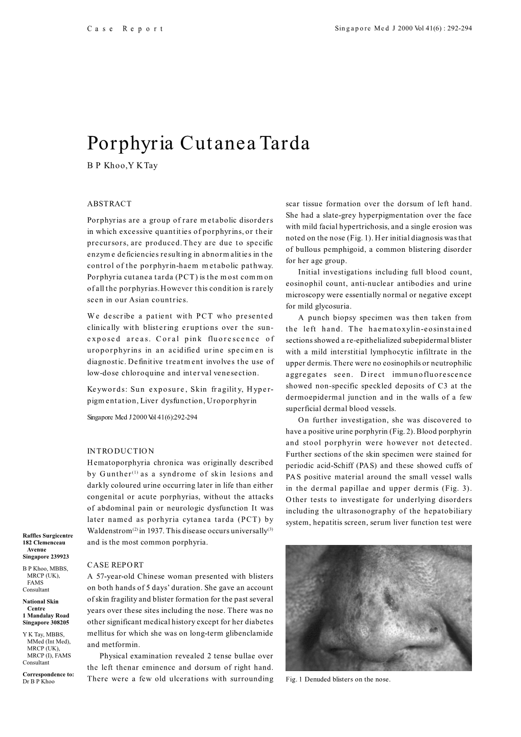 Porphyria Cutanea Tarda B P Khoo, Y K Tay