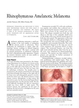 Rhinophymatous Amelanotic Melanoma