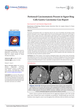 Peritoneal Carcinomatosis Present in Signet Ring Cells Gastric Carcinoma-Case Report