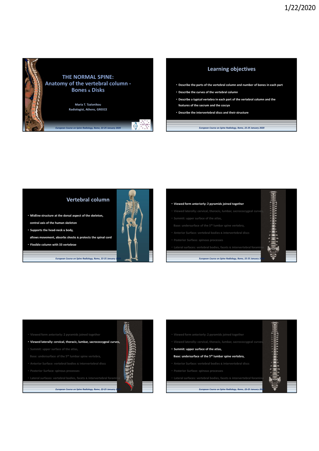 69857-Anatomy of the Vertebral Column