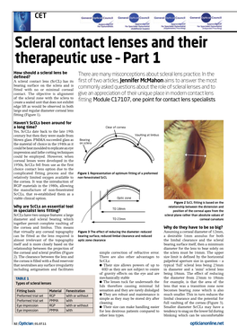Scleral Contact Lenses and Their Therapeutic Use – Part 1 How Should a Scleral Lens Be There Are Many Misconceptions About Scleral Lens Practice