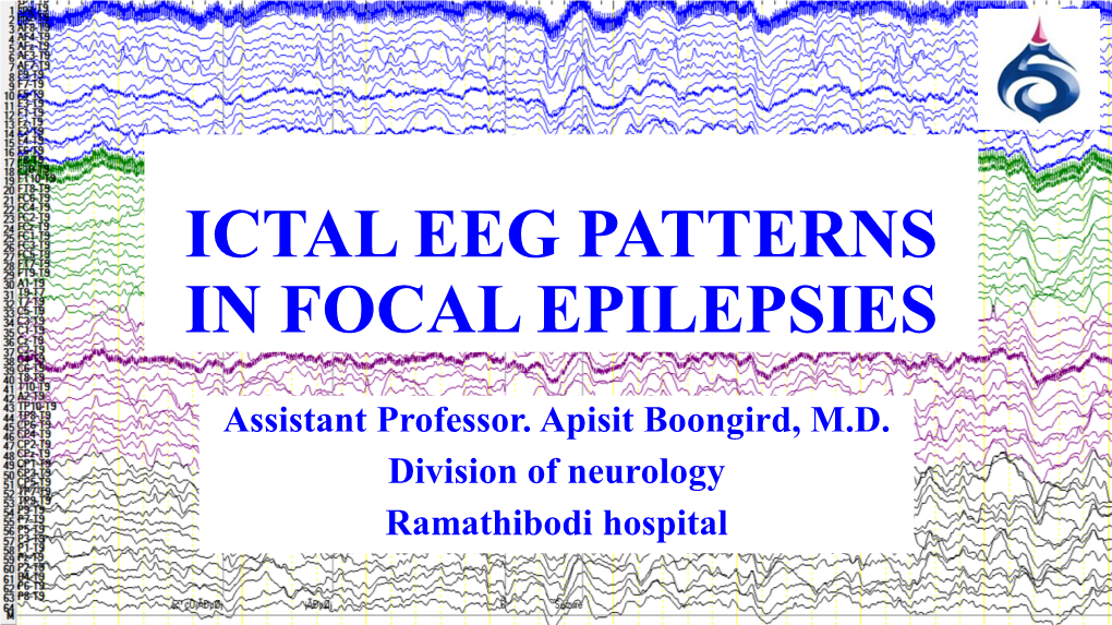 Ictal Eeg Patterns in Adult with Focal Epilepsies