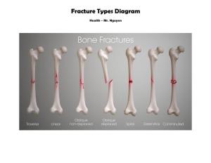 Fracture Types Diagram