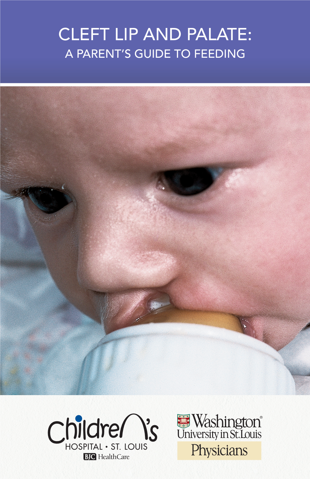 CLEFT LIP and PALATE: a PARENT’S GUIDE to FEEDING Congratulations on the Birth of Your New Child