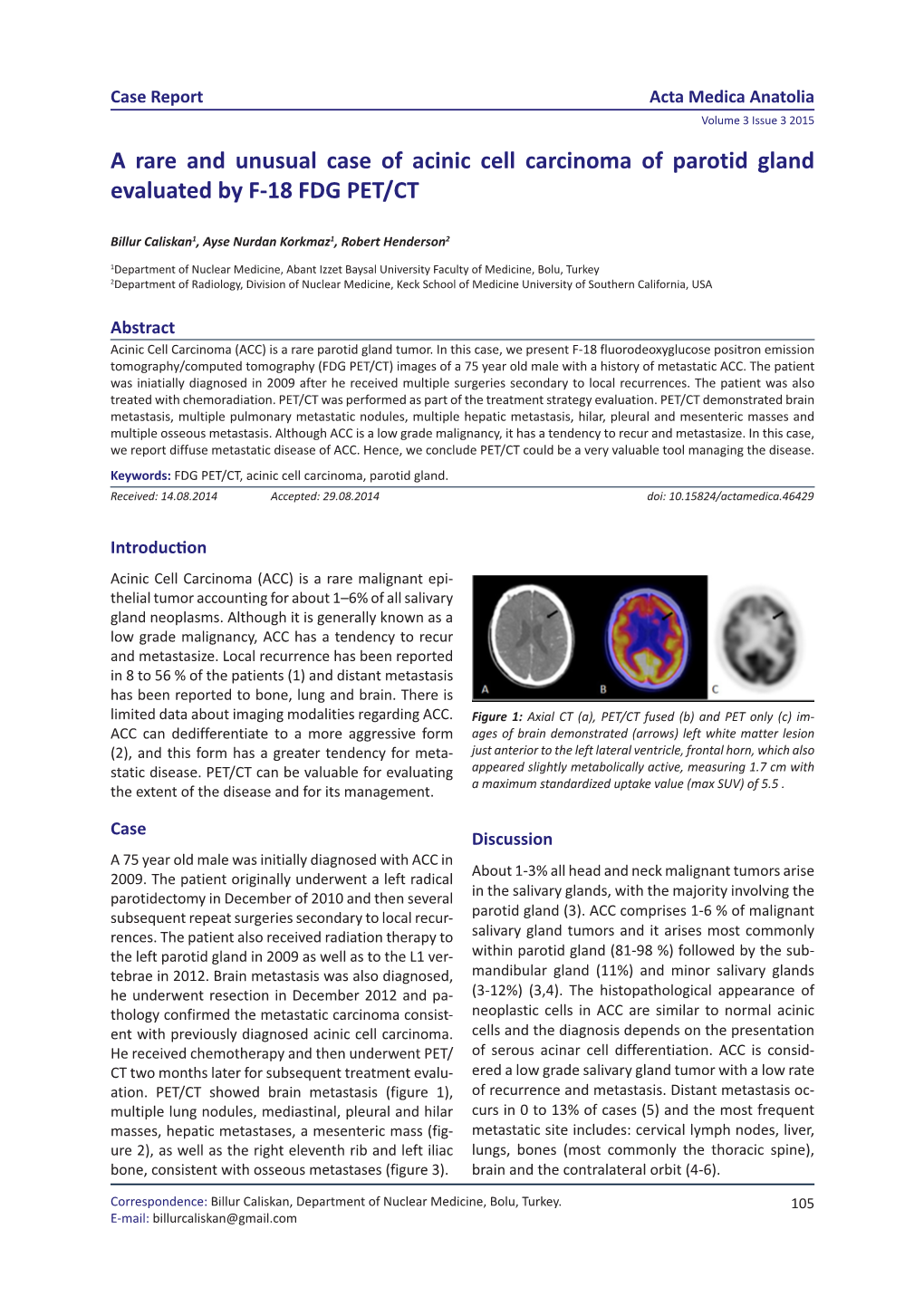 A Rare and Unusual Case of Acinic Cell Carcinoma of Parotid Gland Evaluated by F-18 FDG PET/CT