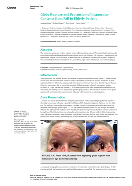 Globe Rupture and Protrusion of Intraocular Contents from Fall in Elderly Patient