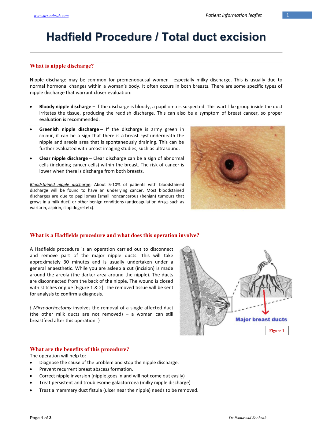 Hadfield Procedure / Total Duct Excision