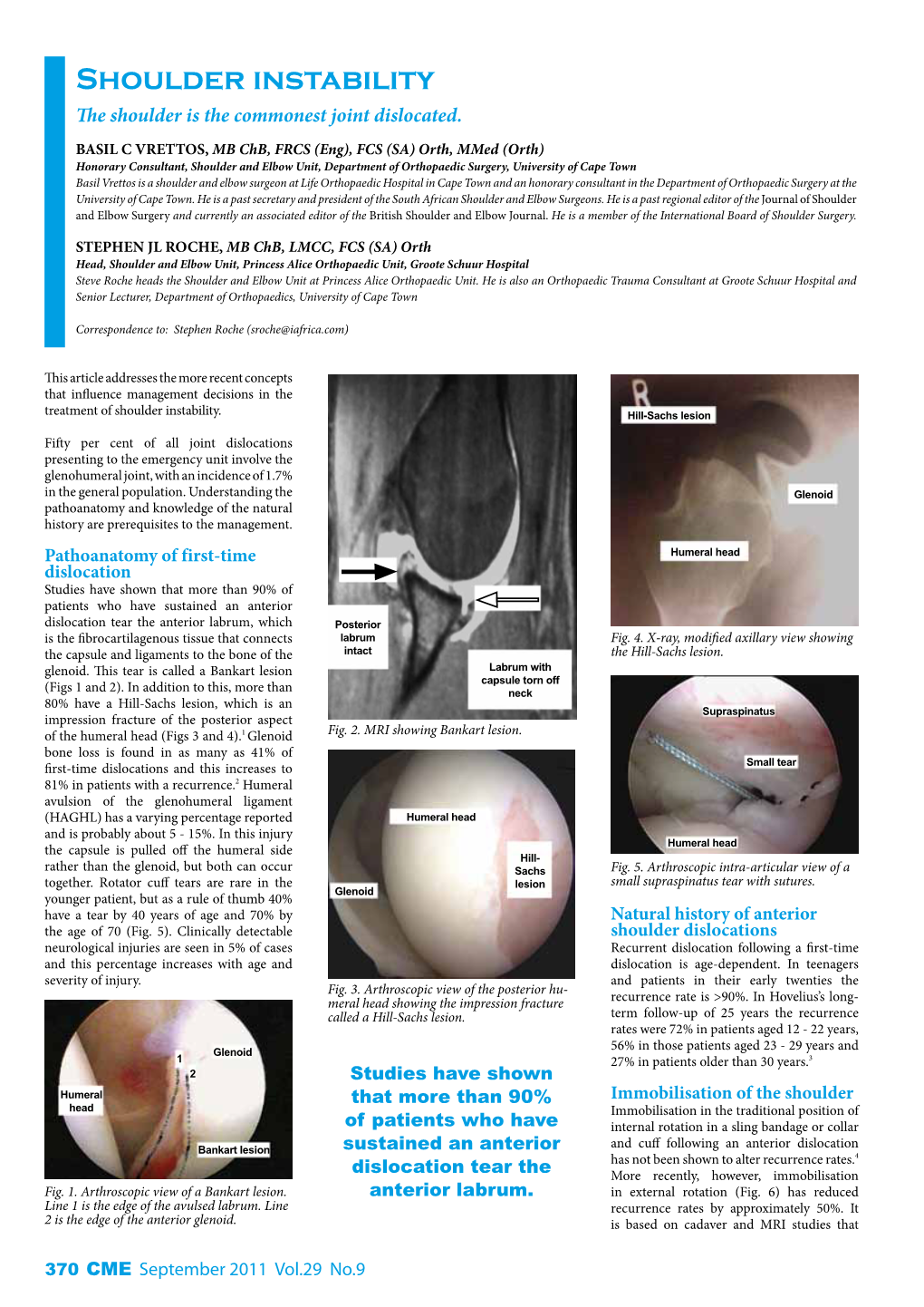 Shoulder Instability the Shoulder Is the Commonest Joint Dislocated