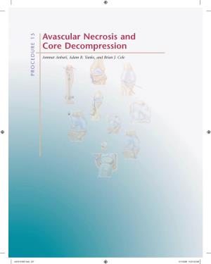 Avascular Necrosis and Core Decompression • Stage IV: Thickening of the Sclerotic Halo, Subchondral Bone Collapse, and Cartilage Flap Formation