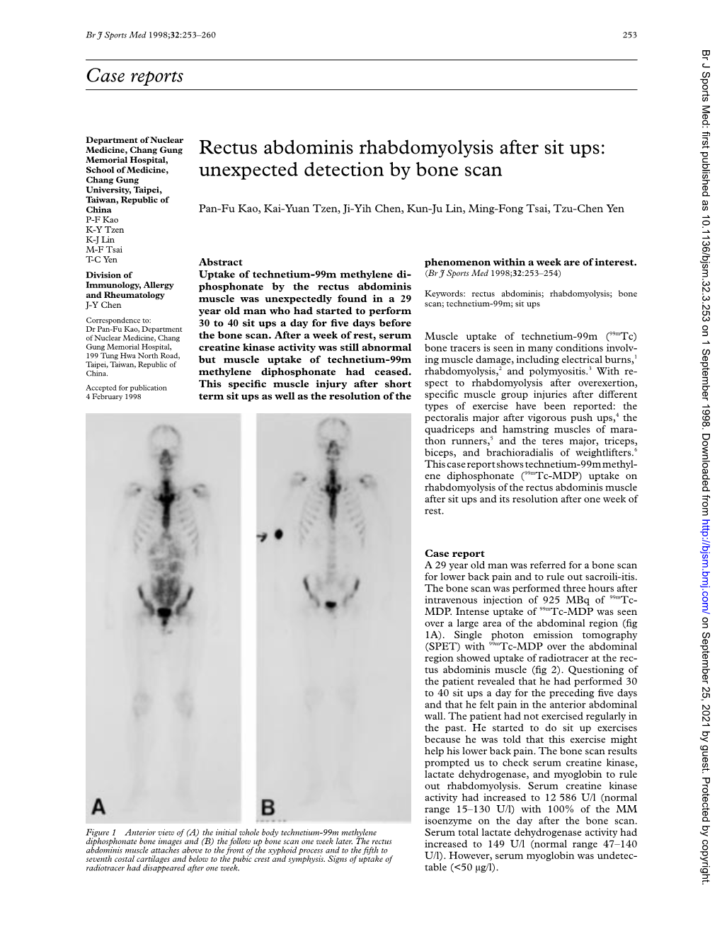 Case Reports Rectus Abdominis Rhabdomyolysis After Sit Ups