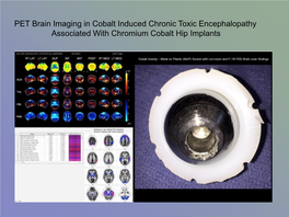 PET Brain Imaging in Cobalt Induced Chronic Toxic Encephalopathy Associated with Chromium Cobalt Hip Implants Clarke’S Three Laws