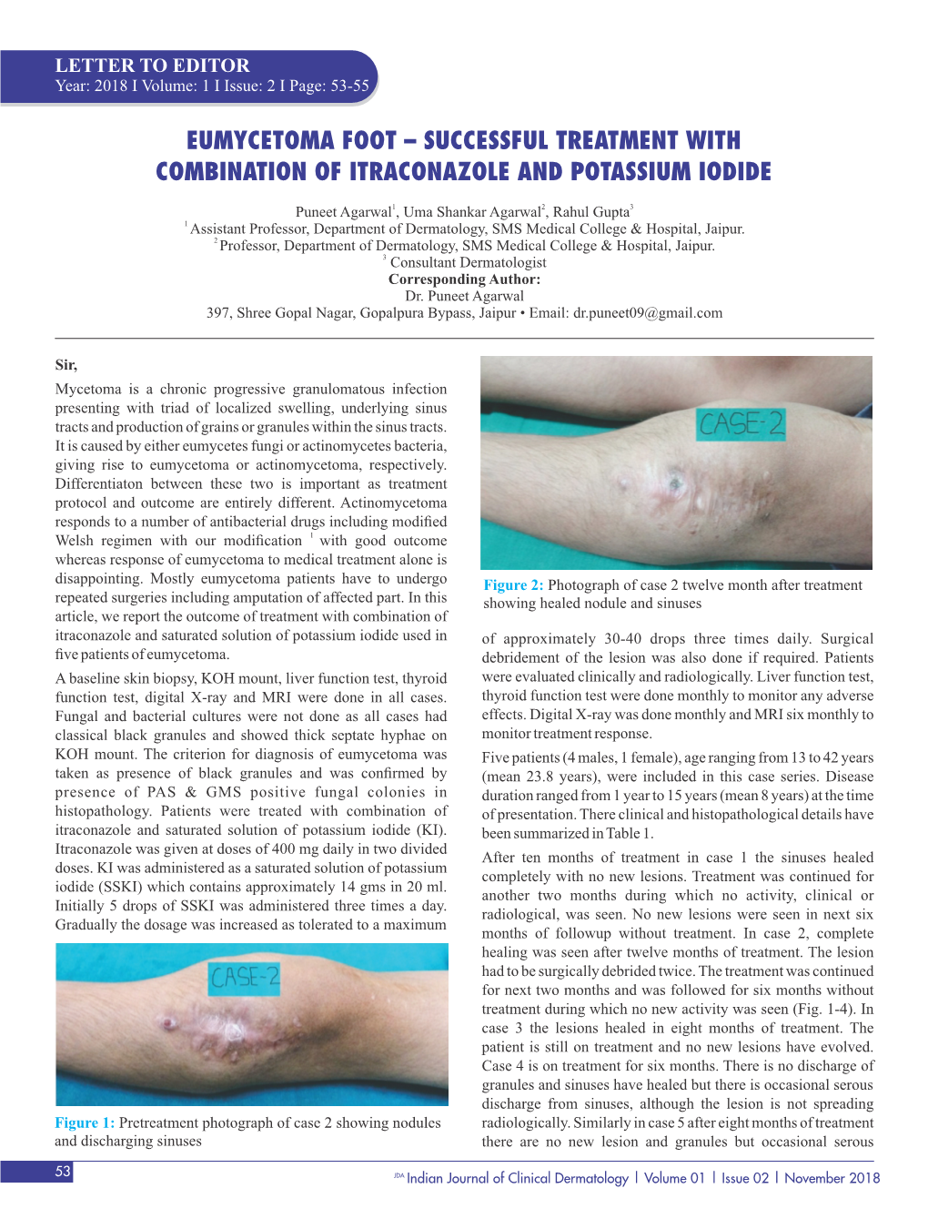 Successful Treatment with Combination of Itraconazole and Potassium Iodide