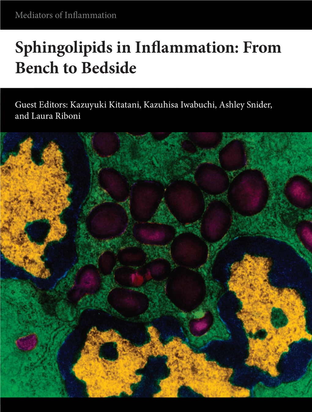 Sphingolipids in Inflammation: from Bench to Bedside