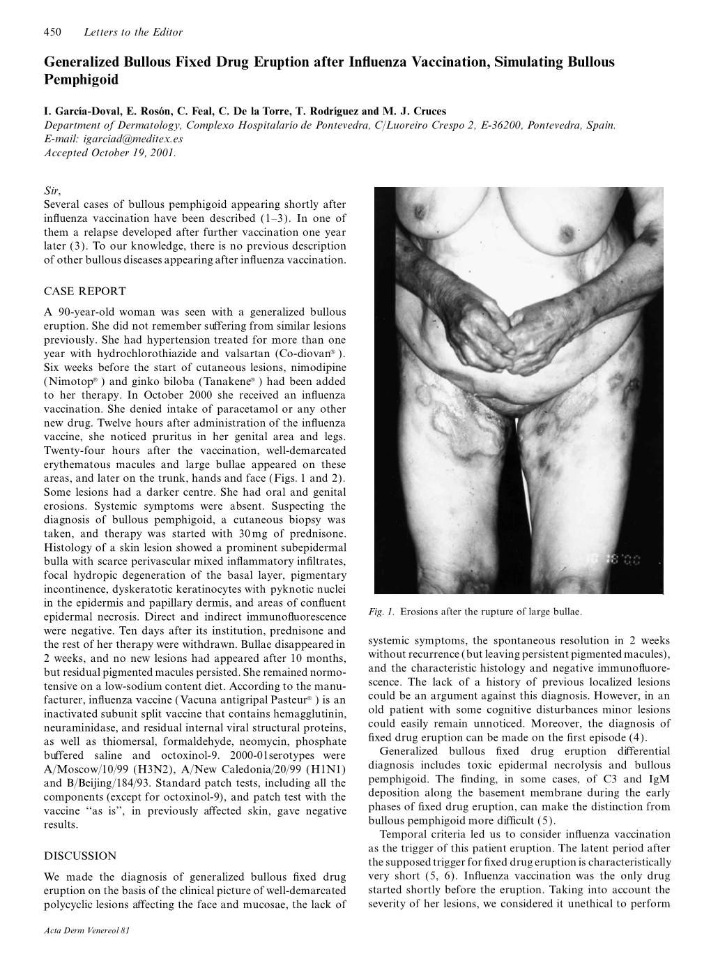 Generalized Bullous Fixed Drug Eruption After Influenza Vaccination