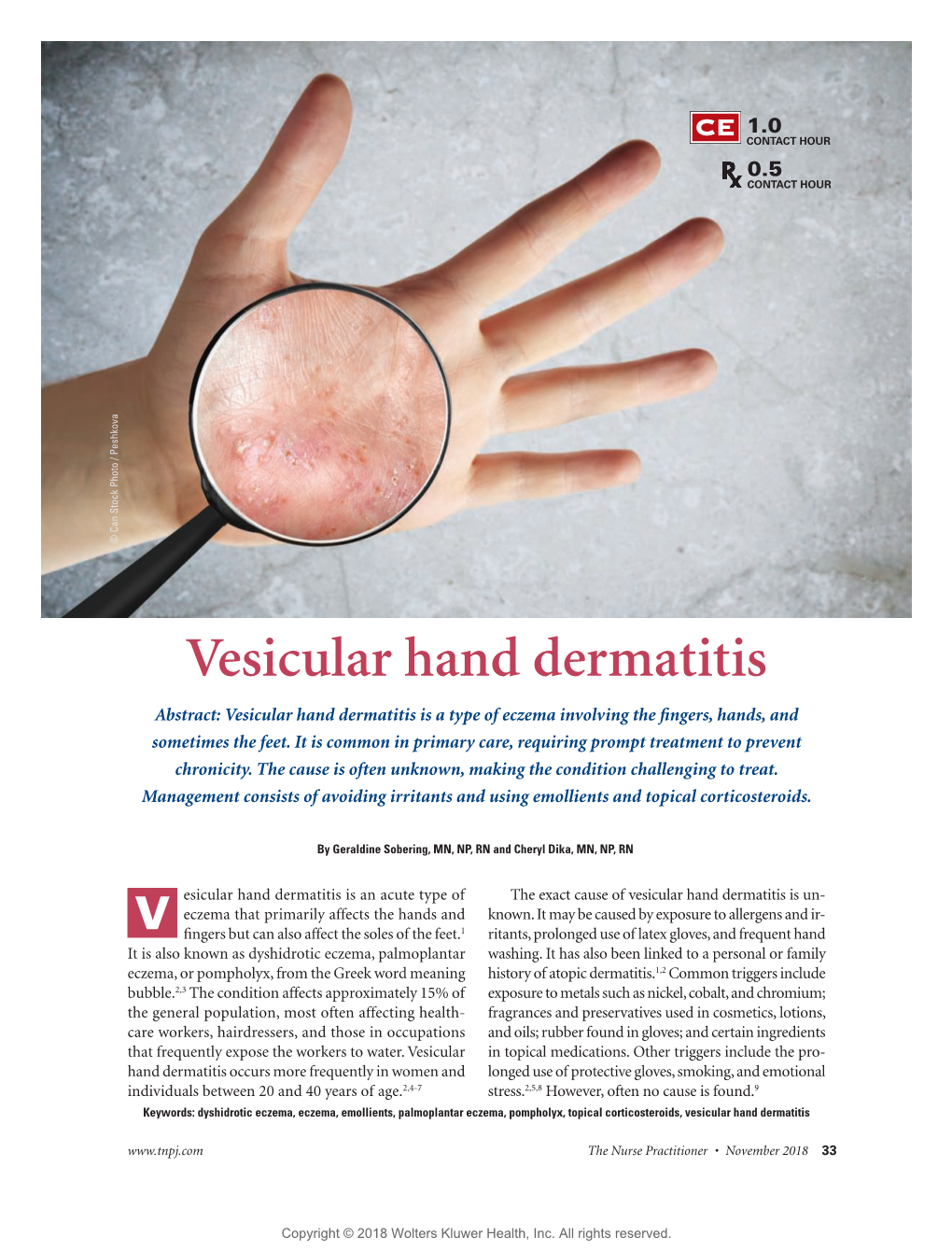 Vesicular Hand Dermatitis Abstract: Vesicular Hand Dermatitis Is a Type of Eczema Involving the ﬁ Ngers, Hands, and Sometimes the Feet