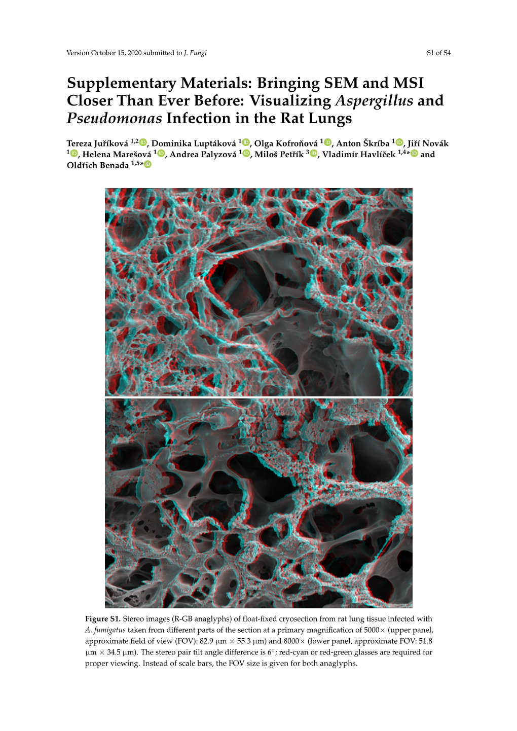 Bringing SEM and MSI Closer Than Ever Before: Visualizing Aspergillus and Pseudomonas Infection in the Rat Lungs