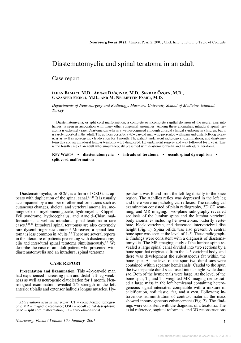 Diastematomyelia and Spinal Teratoma in an Adult. Case Report