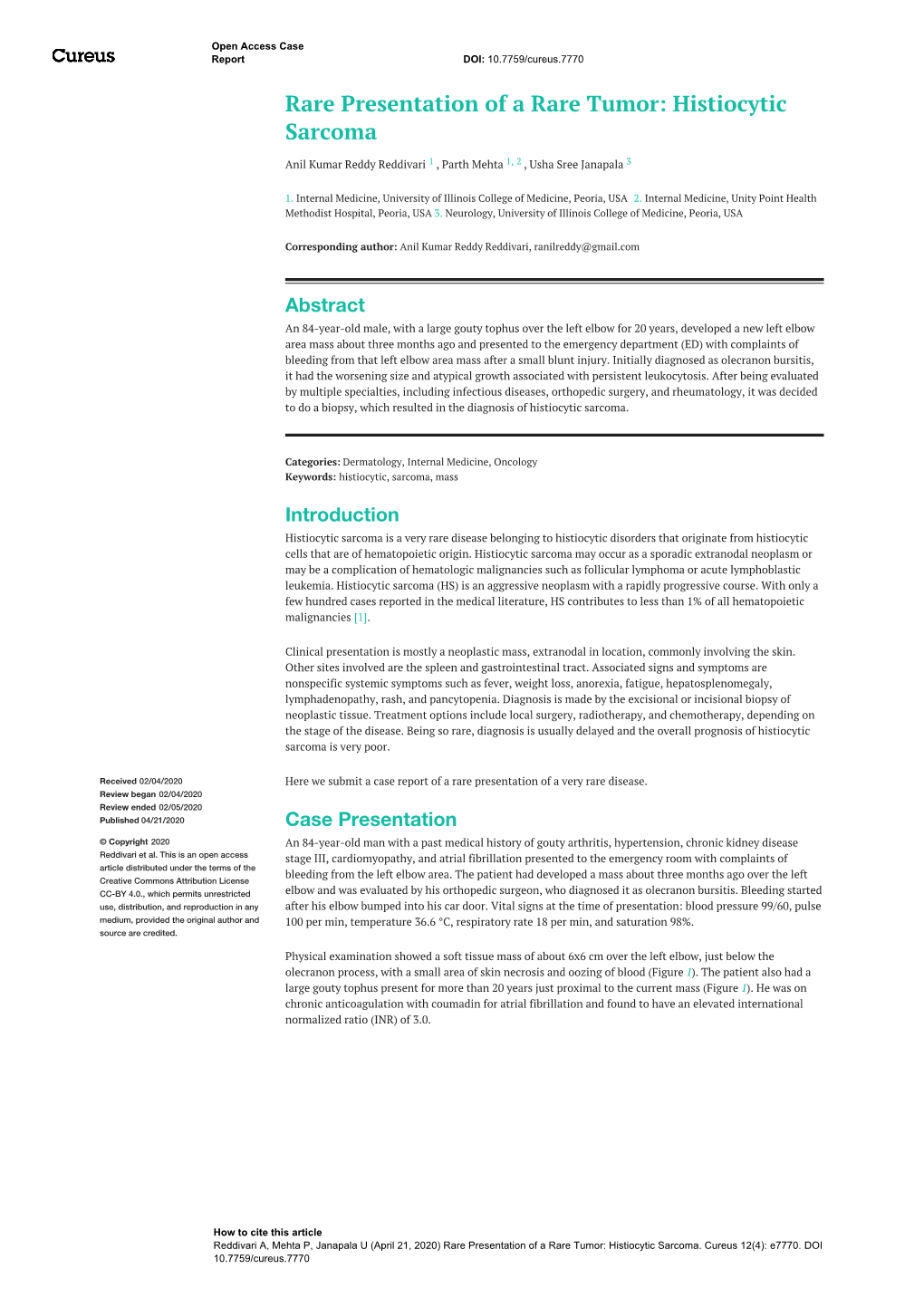 Histiocytic Sarcoma