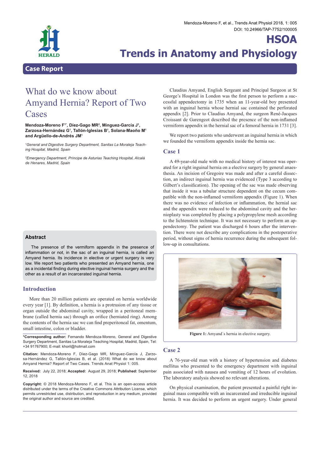 What Do We Know About Amyand Hernia? Report of Two Cases