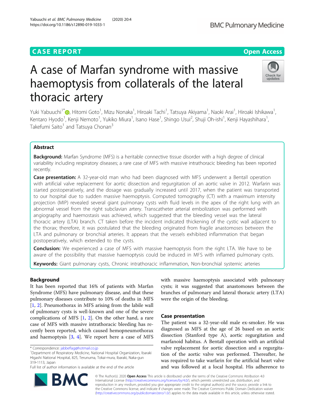 A Case of Marfan Syndrome with Massive Haemoptysis From