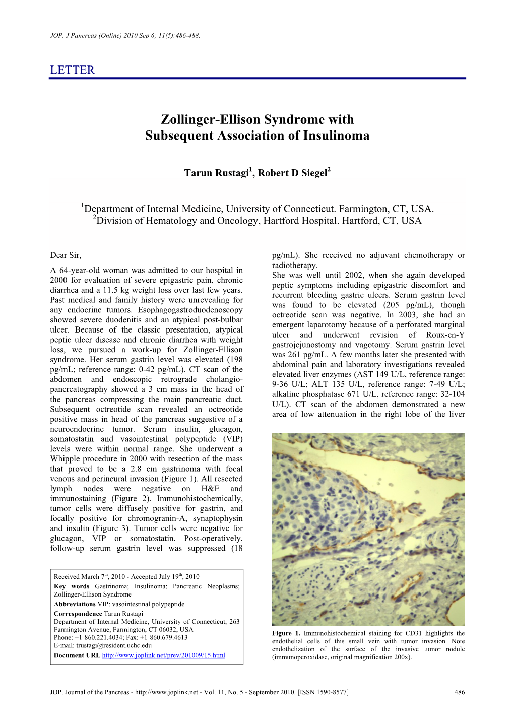 Zollinger-Ellison Syndrome with Subsequent Association of Insulinoma