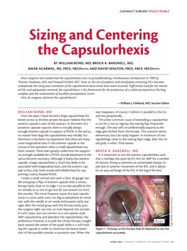 Sizing and Centering the Capsulorhexis by WILLIAM BOND, MD; BROCK K