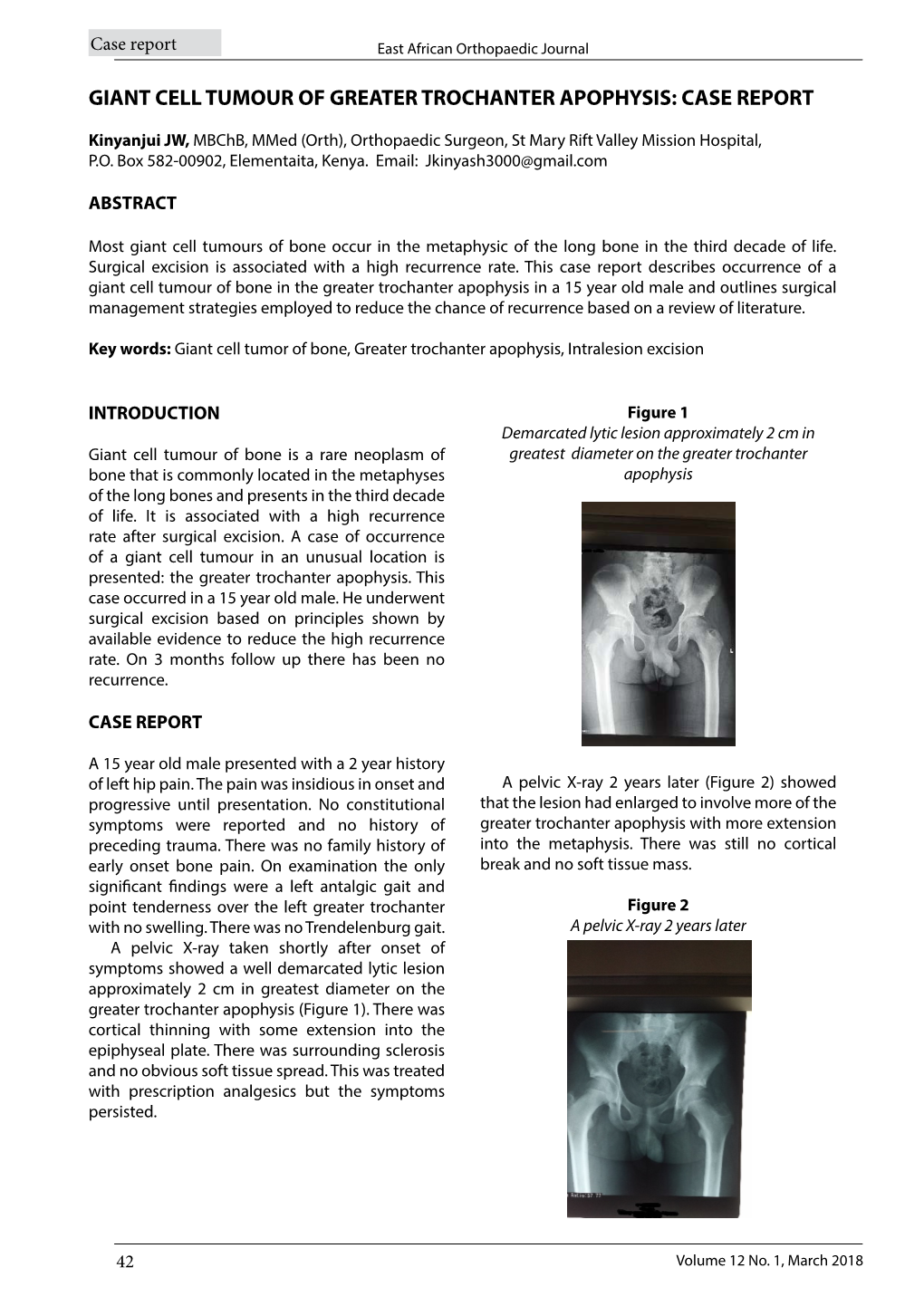 Giant Cell Tumour of Greater Trochanter Apophysis: Case Report