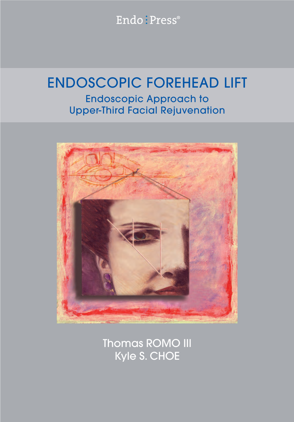 ENDOSCOPIC FOREHEAD LIFT Endoscopic Approach to Upper-Third Facial Rejuvenation