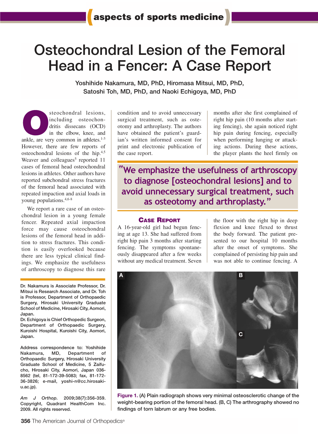 Osteochondral Lesion of the Femoral Head in a Fencer: a Case Report ...