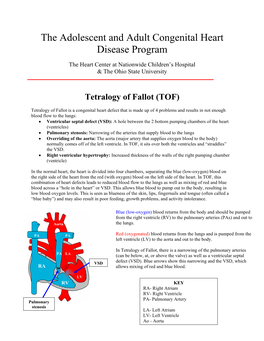 Tetralogy of Fallot (TOF)