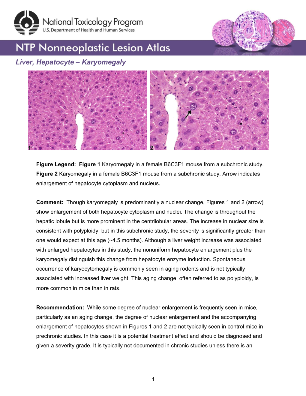 Liver, Hepatocyte – Karyomegaly