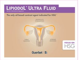The Only Oil-Based Contrast Agent Indicated for HSG1-9