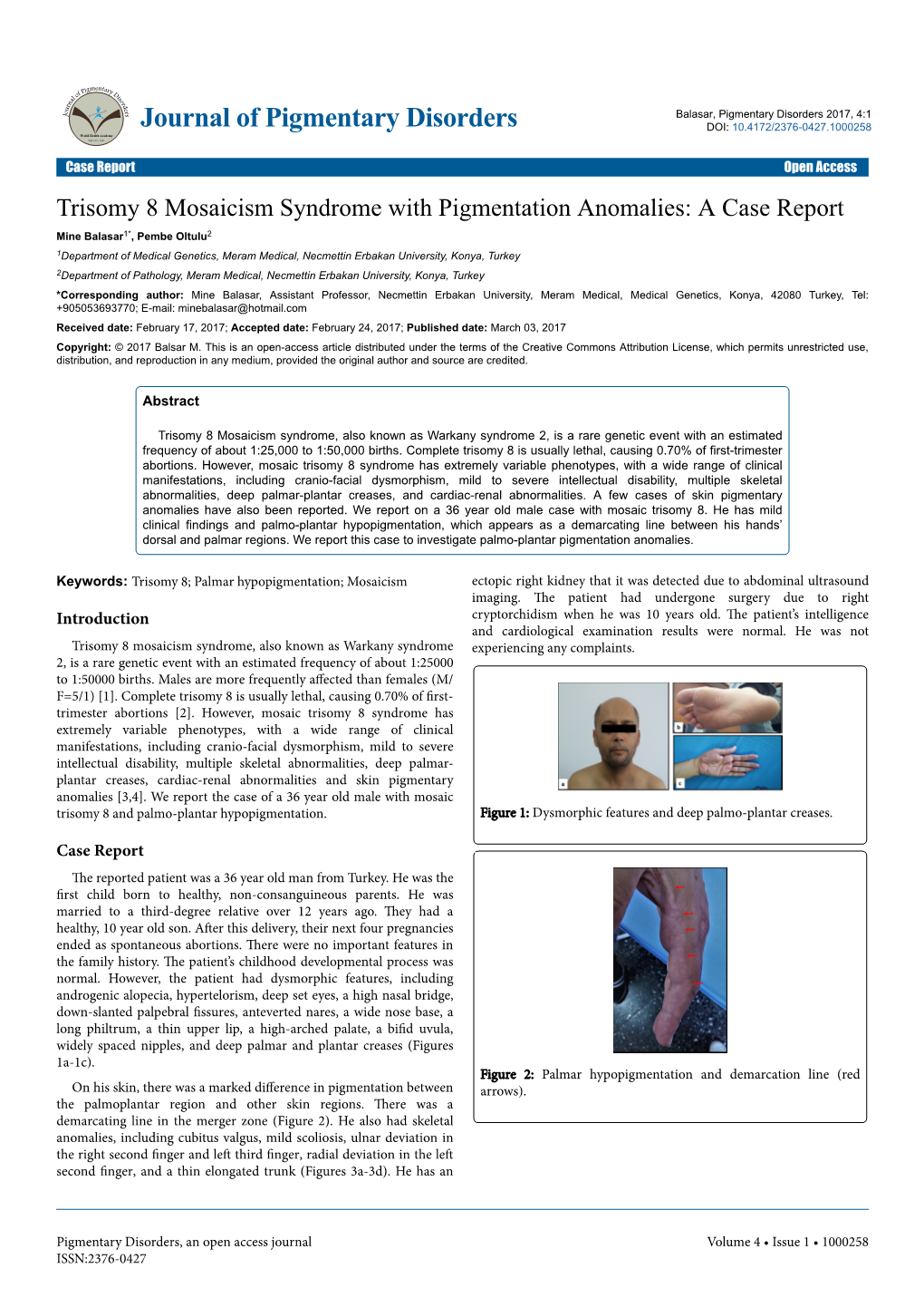 Trisomy 8 Mosaicism Syndrome with Pigmentation Anomalies