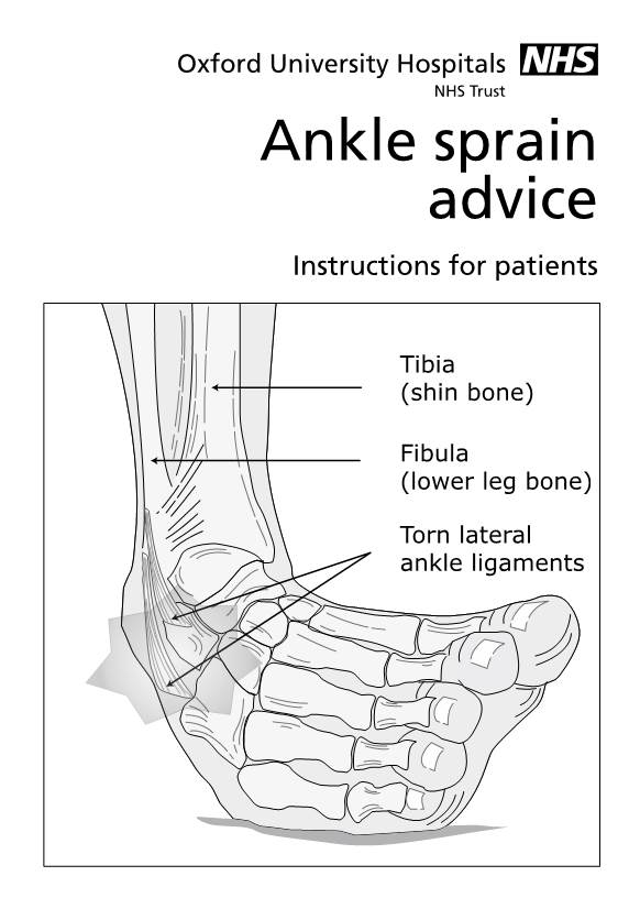 NHS Ankle Sprain Advice