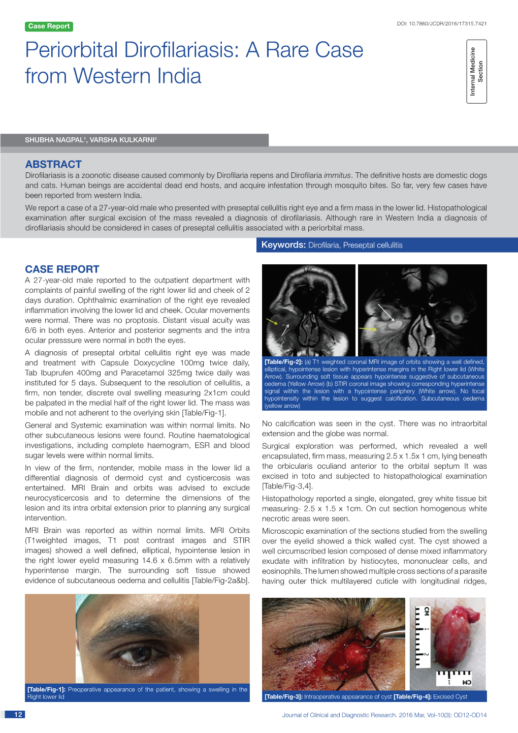 Periorbital Dirofilariasis: a Rare Case