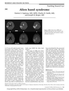 Alien Hand Syndrome Patricio S