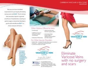 Eliminate Varicose Veins with No Surgery and Scars
