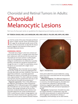 Choroidal Melanocytic Lesions