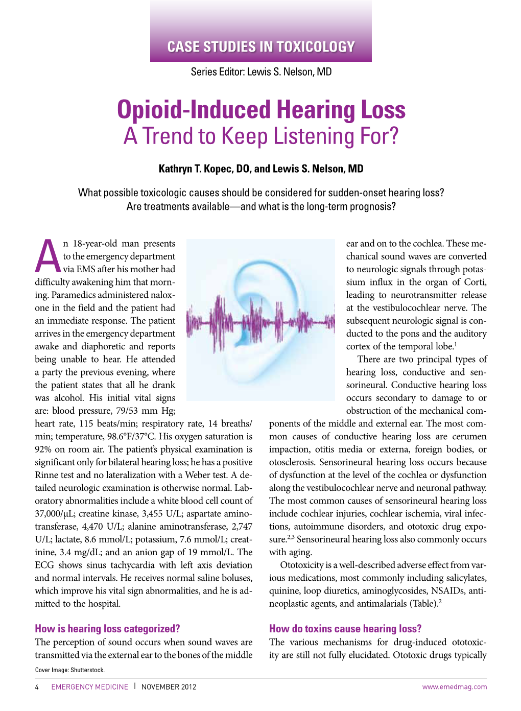 Opioid-Induced Hearing Loss a Trend to Keep Listening For?