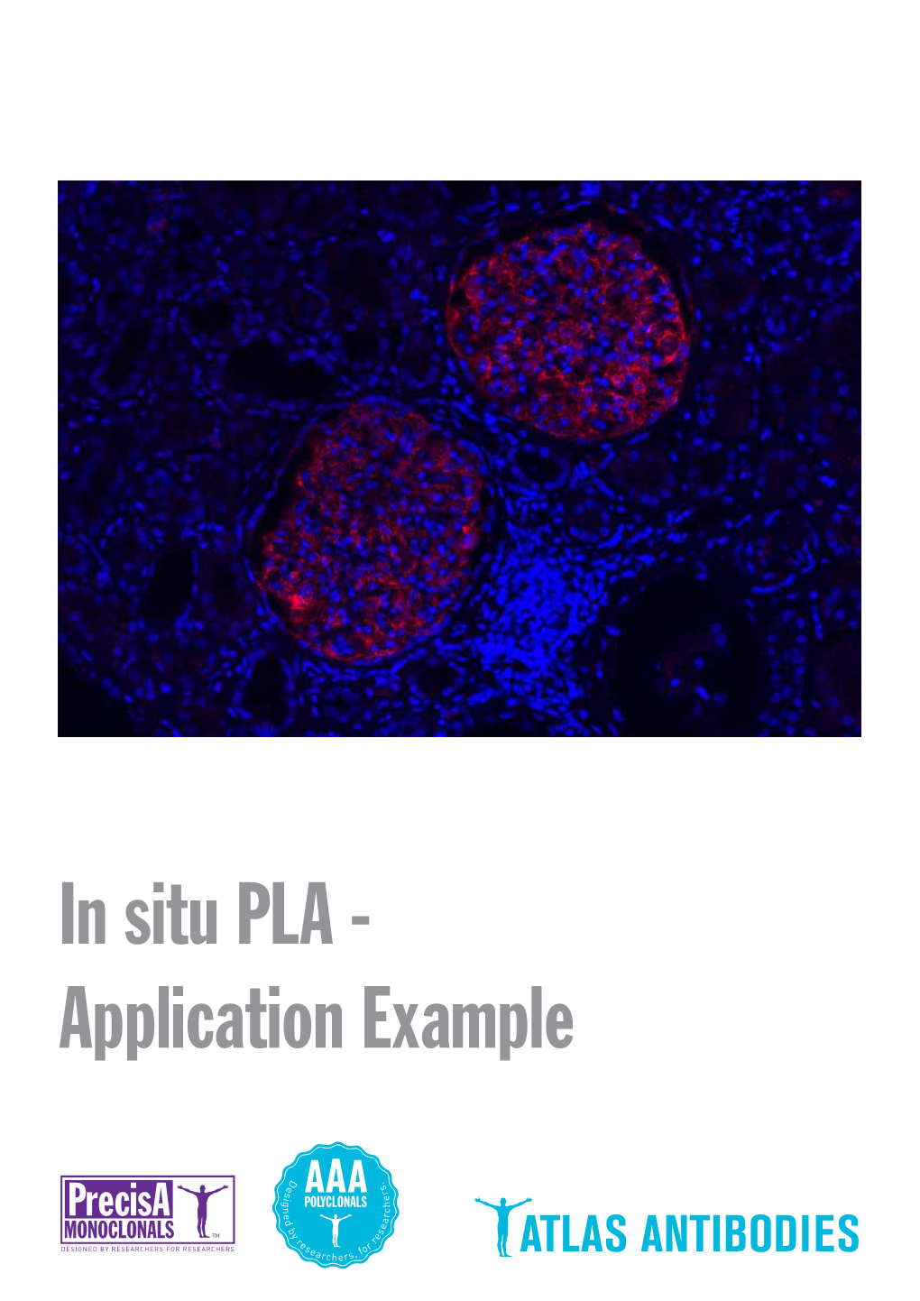 In Situ PLA - Application Example Detection of Protein-Protein Interactions by in Situ PLA with Precisa Monoclonals and Triple a Polyclonals