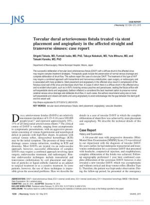Torcular Dural Arteriovenous Fistula Treated Via Stent Placement and Angioplasty in the Affected Straight and Transverse Sinuses: Case Report