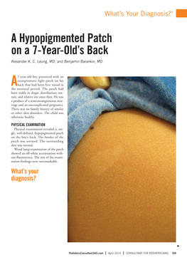 A Hypopigmented Patch on a 7-Year-Old's Back