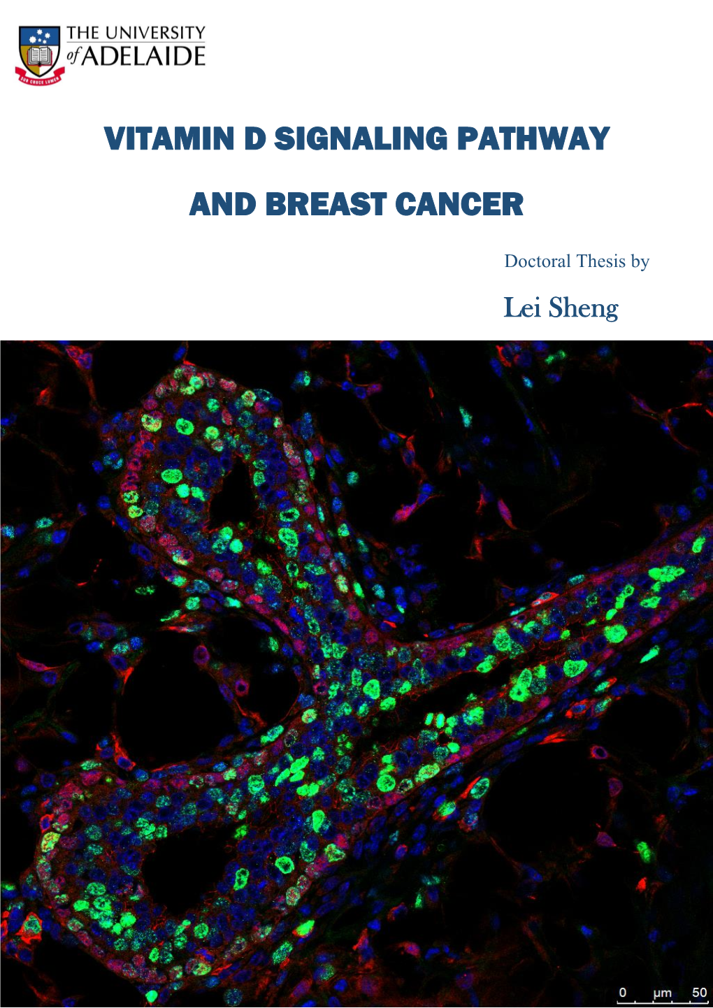 Vitamin D Signaling Pathway and Breast Cancer