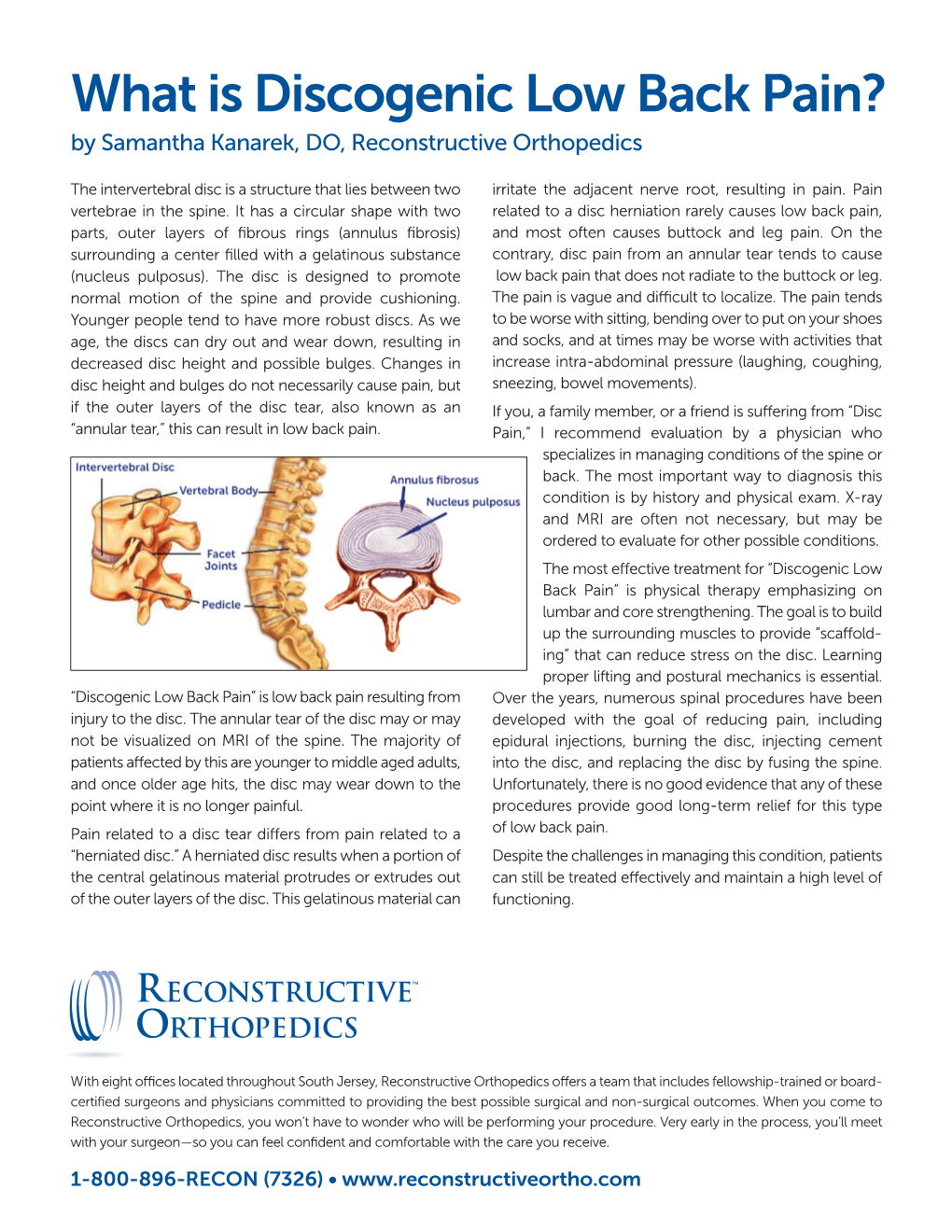 What Is Discogenic Low Back Pain? by Samantha Kanarek, DO, Reconstructive Orthopedics
